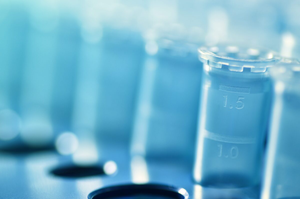 Close-up of laboratory test tubes, symbolizing innovative biotech investment strategies and advancements in medical research